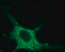 Anti-Sodium Channel PN1 antibody produced in rabbit affinity isolated antibody, lyophilized powder