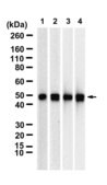 Anti-SGK1 Antibody, clone 2N11 ZooMAb® Rabbit Monoclonal recombinant, expressed in HEK 293 cells