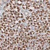 Anti-HK1 antibody produced in rabbit Prestige Antibodies&#174; Powered by Atlas Antibodies, affinity isolated antibody, buffered aqueous glycerol solution