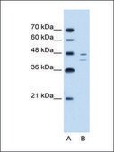 Anti-FAH antibody produced in rabbit IgG fraction of antiserum