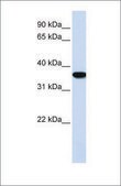Anti-HMOX1 affinity isolated antibody