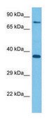 Anti-NSMCE4A (C-terminal) antibody produced in rabbit affinity isolated antibody