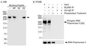 Rabbit anti-Phospho RNA Polymerase II (S2) Antibody, Affinity Purified Powered by Bethyl Laboratories, Inc.