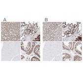 Anti-PDIA5 antibody produced in rabbit Prestige Antibodies® Powered by Atlas Antibodies, affinity isolated antibody, buffered aqueous glycerol solution, ab3