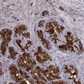 Anti-SEMG1 antibody produced in rabbit Prestige Antibodies&#174; Powered by Atlas Antibodies, affinity isolated antibody, buffered aqueous glycerol solution