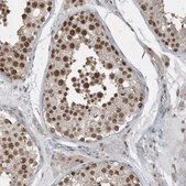 Anti-YTHDC1 antibody produced in rabbit Prestige Antibodies&#174; Powered by Atlas Antibodies, affinity isolated antibody, buffered aqueous glycerol solution