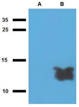 Anti-Tb7.7 (M. tuberculosis) antibody produced in rabbit