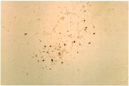 Anti-Synuclein &#945; Antibody serum, Chemicon&#174;
