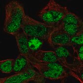 Anti-COL2A1 antibody produced in rabbit Prestige Antibodies® Powered by Atlas Antibodies, affinity isolated antibody