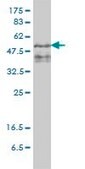 Monoclonal Anti-ZFYVE19 antibody produced in mouse clone 4D5-2D11, purified immunoglobulin, buffered aqueous solution
