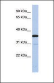 Anti-ESD, (N-terminal) antibody produced in rabbit affinity isolated antibody