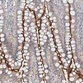 Anti-MAT2B antibody produced in rabbit Prestige Antibodies&#174; Powered by Atlas Antibodies, affinity isolated antibody, buffered aqueous glycerol solution