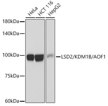 Anti-LSD2/KDM1B/AOF1 Antibody, clone 5M3W2, Rabbit Monoclonal