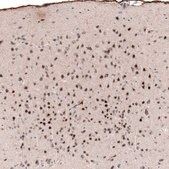 Monoclonal Anti-POU3F2 antibody produced in mouse Prestige Antibodies&#174; Powered by Atlas Antibodies, clone CL6232, purified immunoglobulin, buffered aqueous glycerol solution