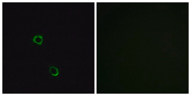 Anti-OR2M2 antibody produced in rabbit affinity isolated antibody
