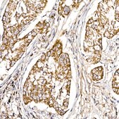 Anti-UQCRH Antibody, clone 4Z1R9, Rabbit Monoclonal