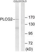 Anti-PLCG2 antibody produced in rabbit affinity isolated antibody