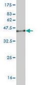 Monoclonal Anti-CIDEB antibody produced in mouse clone 2A10, purified immunoglobulin, buffered aqueous solution