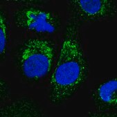 Anti-ALDH16A1 antibody produced in rabbit Prestige Antibodies&#174; Powered by Atlas Antibodies, affinity isolated antibody, buffered aqueous glycerol solution
