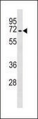 ANTI-MOUSE TGFBR2 (C-TERM) antibody produced in rabbit IgG fraction of antiserum, buffered aqueous solution