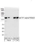 Rabbit anti-TIF1 Alpha/TRIM24 Antibody, Affinity Purified Powered by Bethyl Laboratories, Inc.