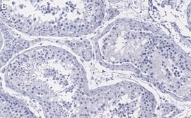 Anti-KLF5 Antibody, clone 1J12 ZooMAb&#174; Rabbit Monoclonal recombinant, expressed in HEK 293 cells