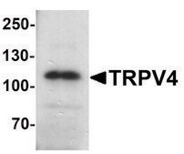 Anti-TRPV4 antibody produced in rabbit affinity isolated antibody