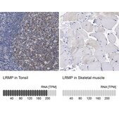 Anti-LRMP antibody produced in rabbit Prestige Antibodies® Powered by Atlas Antibodies, affinity isolated antibody, buffered aqueous glycerol solution