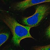 Anti-PLCG1 antibody produced in rabbit Prestige Antibodies&#174; Powered by Atlas Antibodies, affinity isolated antibody, buffered aqueous glycerol solution