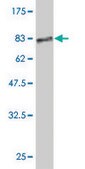Monoclonal Anti-KRT18 antibody produced in mouse clone 1G8, purified immunoglobulin, buffered aqueous solution