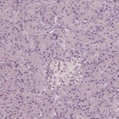 Anti-CCDC170 antibody produced in rabbit Prestige Antibodies&#174; Powered by Atlas Antibodies, affinity isolated antibody, buffered aqueous glycerol solution