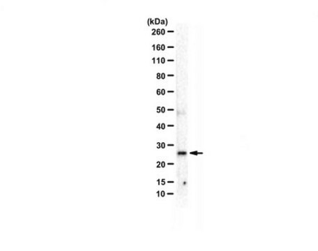 Anti-C9orf72 (short form) from rabbit