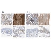 Anti-DYSF antibody produced in rabbit Prestige Antibodies&#174; Powered by Atlas Antibodies, affinity isolated antibody, buffered aqueous glycerol solution