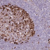 Anti-EEF1A1 antibody produced in rabbit Prestige Antibodies&#174; Powered by Atlas Antibodies, affinity isolated antibody, buffered aqueous glycerol solution