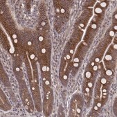 抗-MYO19 兔抗 Prestige Antibodies&#174; Powered by Atlas Antibodies, affinity isolated antibody