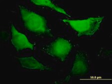 Anti-CDC45L antibody produced in mouse purified immunoglobulin, buffered aqueous solution