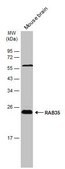 Anti-RAB35 antibody produced in rabbit affinity isolated antibody, buffered aqueous solution