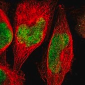 Anti-ZNF134 antibody produced in rabbit Prestige Antibodies® Powered by Atlas Antibodies, affinity isolated antibody, buffered aqueous glycerol solution