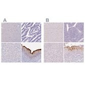 抗-UPK2 兔抗 Prestige Antibodies&#174; Powered by Atlas Antibodies, affinity isolated antibody, buffered aqueous glycerol solution