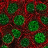 Anti-PRELID3B antibody produced in rabbit Prestige Antibodies&#174; Powered by Atlas Antibodies, affinity isolated antibody, buffered aqueous glycerol solution