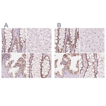 Anti-HOXB13 antibody produced in rabbit Prestige Antibodies® Powered by Atlas Antibodies, affinity isolated antibody, buffered aqueous glycerol solution