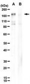 Anti-SARS-CoV-2 Spike RBD Antibody, clone 1A4-3F8