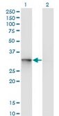 Monoclonal Anti-UBE2R2 antibody produced in mouse clone 5E7, purified immunoglobulin, buffered aqueous solution