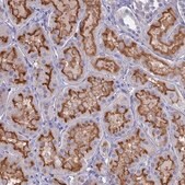 Anti-SLC2A6 antibody produced in rabbit Prestige Antibodies&#174; Powered by Atlas Antibodies, affinity isolated antibody, buffered aqueous glycerol solution
