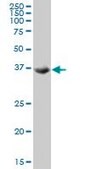 ANTI-TSSK2 antibody produced in mouse clone 1F6, purified immunoglobulin, buffered aqueous solution