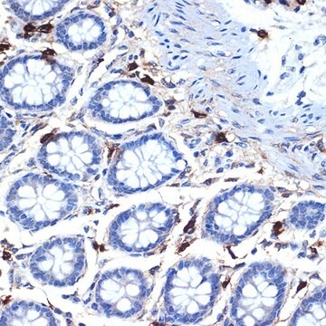Anti-Mast Cell Tryptase (TPSB2) antibody produced in rabbit