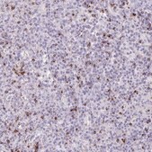 Anti-GZMK antibody produced in rabbit Prestige Antibodies&#174; Powered by Atlas Antibodies, affinity isolated antibody, buffered aqueous glycerol solution