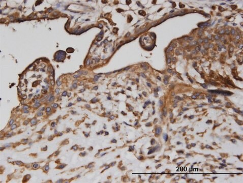 Monoclonal Anti-AP2B1 antibody produced in mouse clone 2D5, purified immunoglobulin, buffered aqueous solution