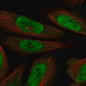 Anti-MLLT1 antibody produced in rabbit Prestige Antibodies&#174; Powered by Atlas Antibodies, affinity isolated antibody, buffered aqueous glycerol solution