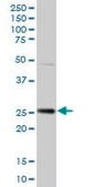 Anti-HPGD antibody produced in mouse purified immunoglobulin, buffered aqueous solution